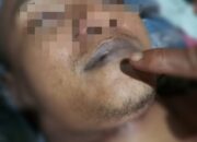 Misteri Kematian Napi Rutan Sidrap: Keterangan Polisi dan Karutan Berbeda, Ada Apa?