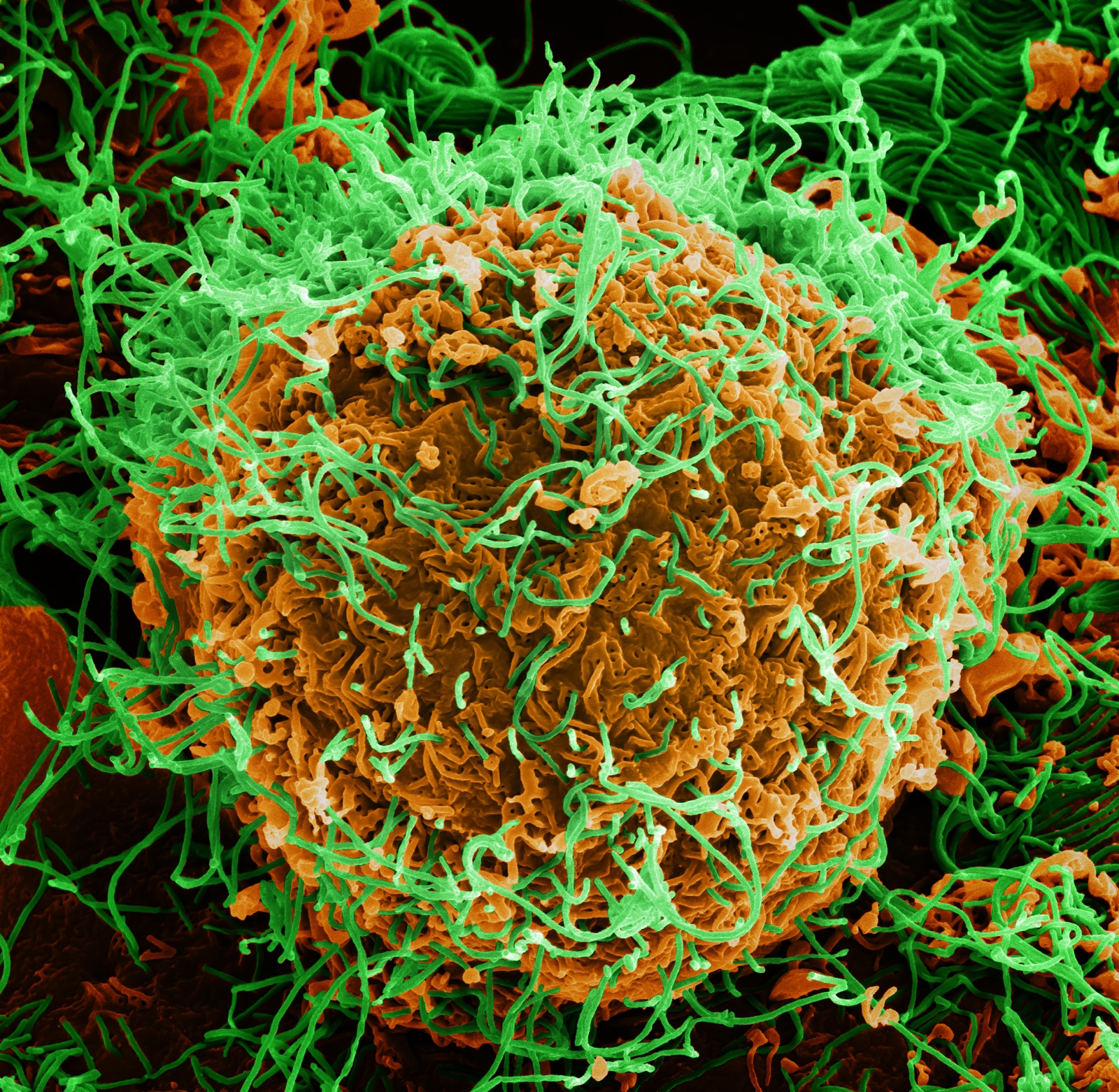 Ebola RD Kongo Tembus 5.021 Kasus, Korban Jiwa Capai 2.378 Orang