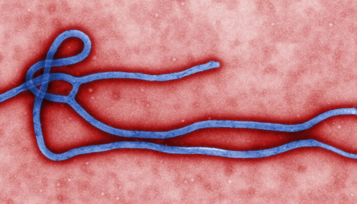 Wabah Ebola Kongo Meluas, 5.794 Kasus, 2.786 Orang Meninggal