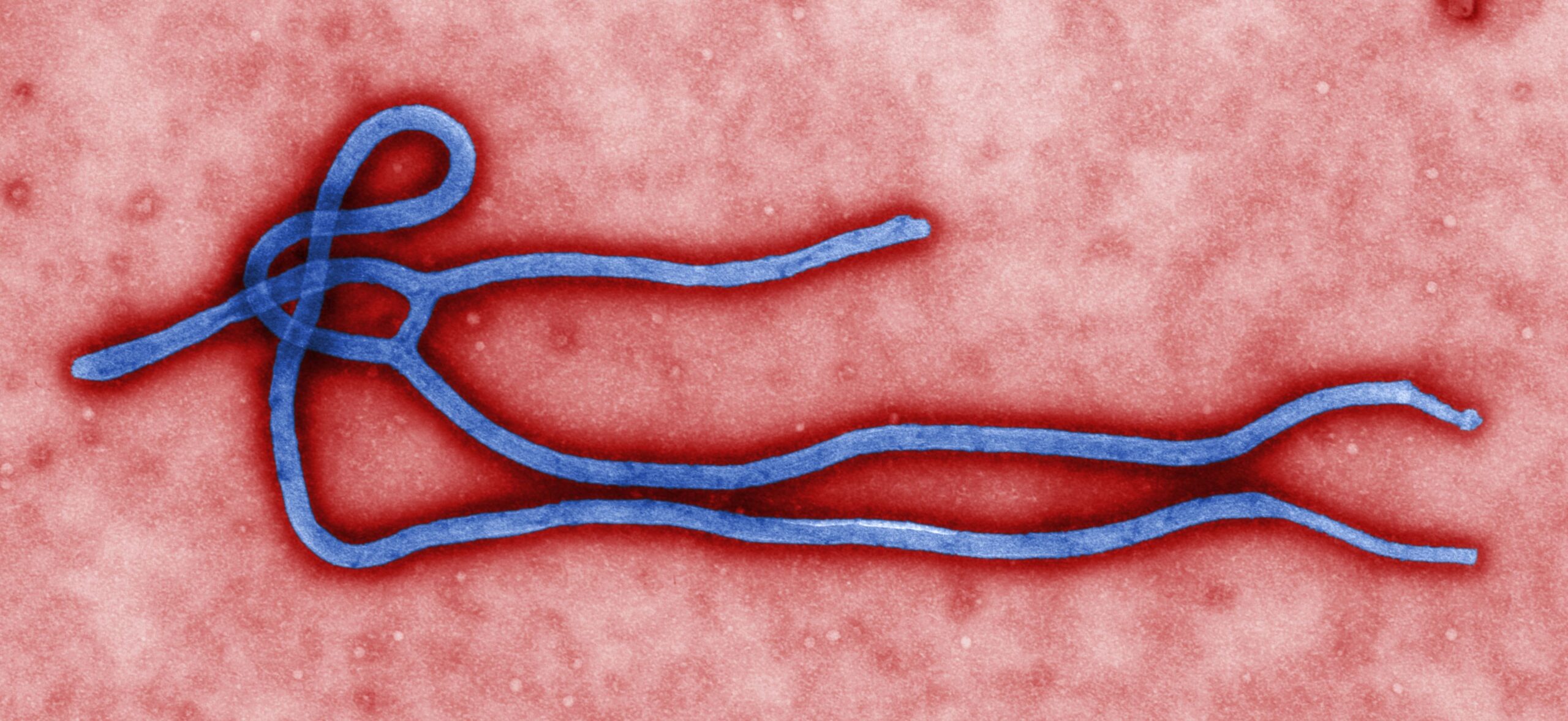 Wabah Ebola Kongo Meluas, 5.794 Kasus, 2.786 Orang Meninggal